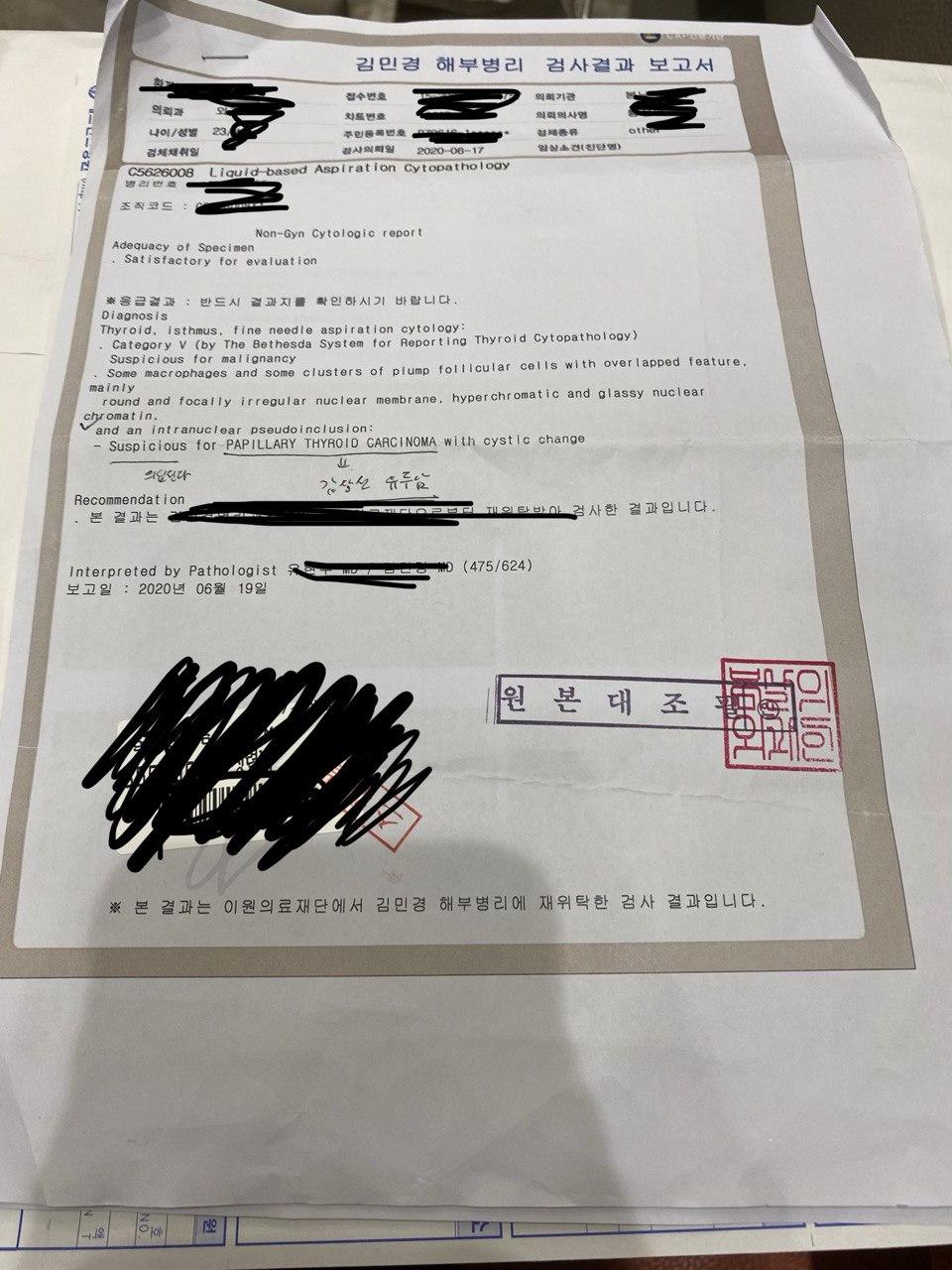 갑상선 암 (갑상선 유두암) 진단 후기